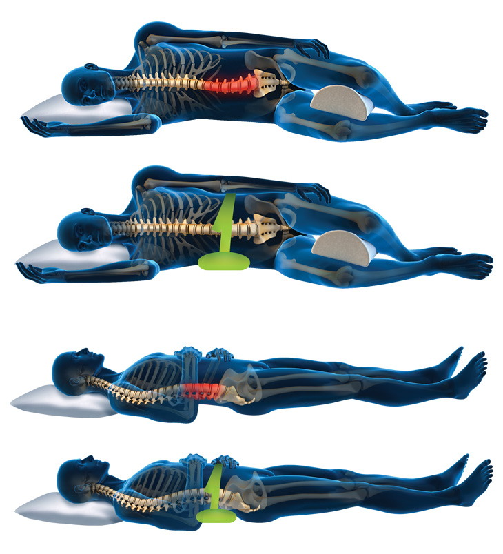 What Is Lumbar Support and Why Do I Need It?